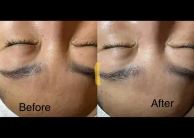 Before & After